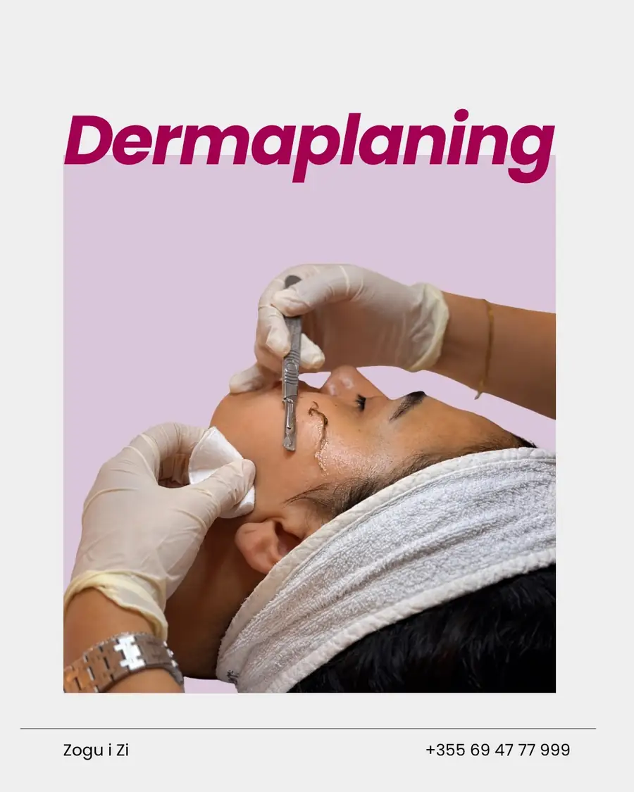 Dermaplaning heq qelizat e vdekura dhe pushin e imët të fytyrës, duke e bërë lëkurën më të lëmuar dh