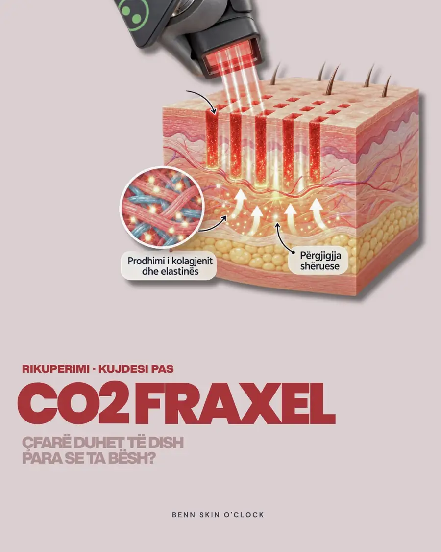 CO₂ Fraxel: nga përgatitja te rikuperimi. 